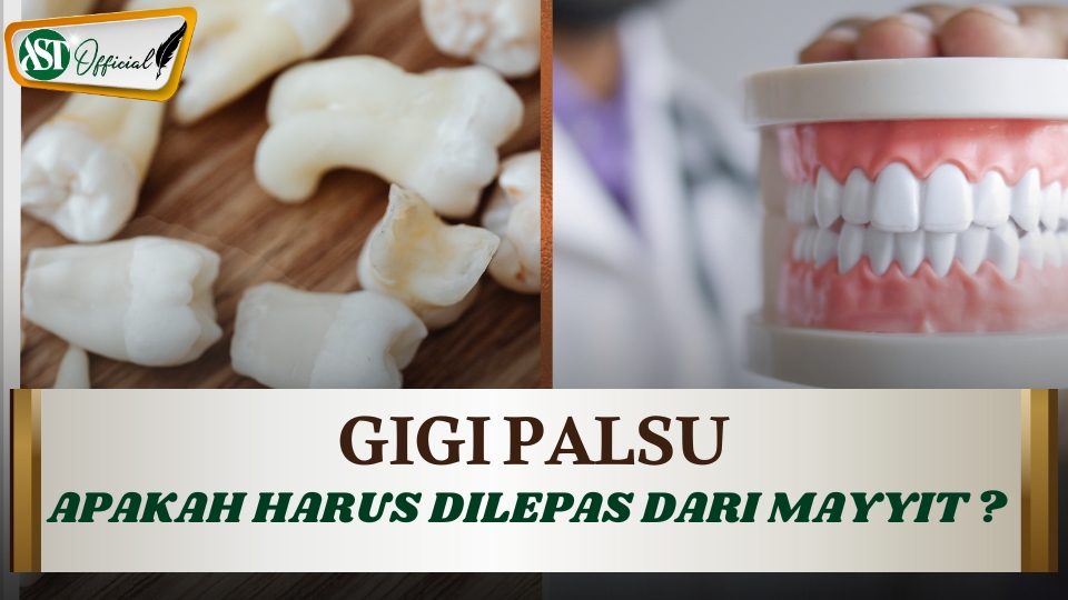 GIGI PALSU APAKAH HARUS DILEPAS DARI MAYIT?